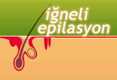 Iğneli Epilasyon Nedir?